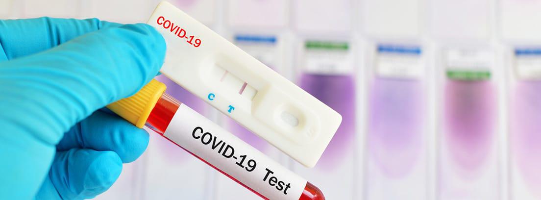test-coronavirus