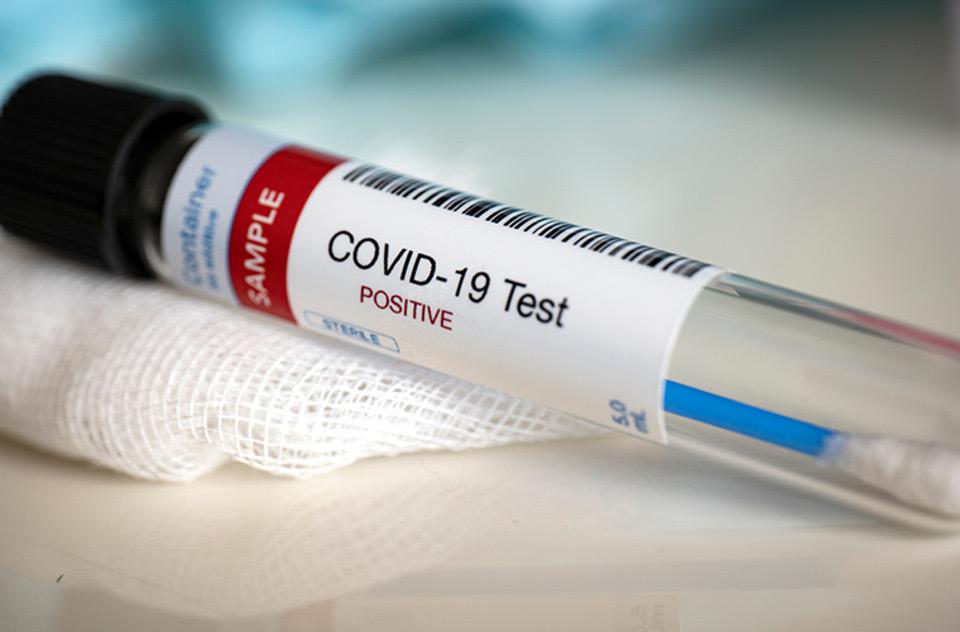 coronavirus-positivo-2