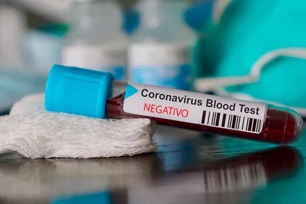 CORONAVIRUS COVID-19