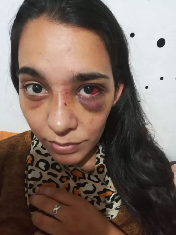 estaaaaaaaaaaaaaaaaaaaaa