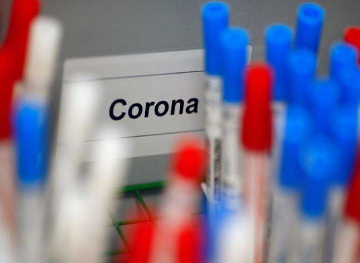 15756-coronavirus3