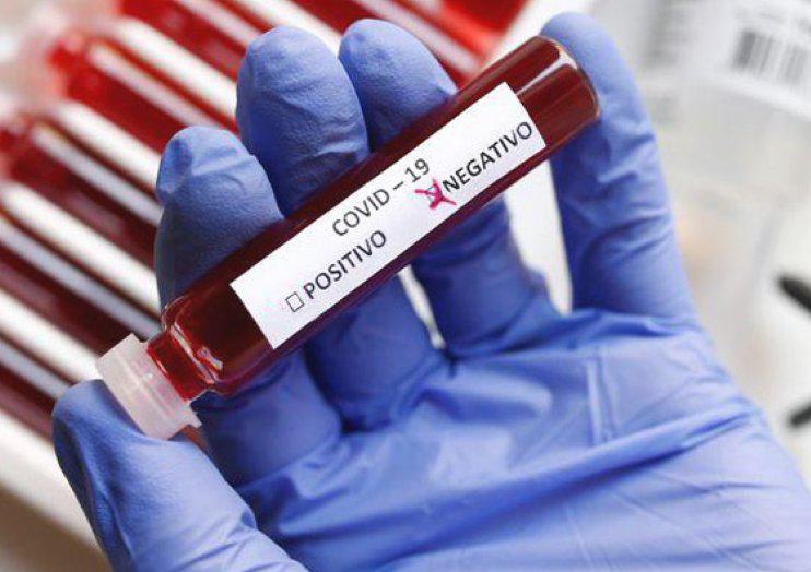 13325-coronavirus-negativo